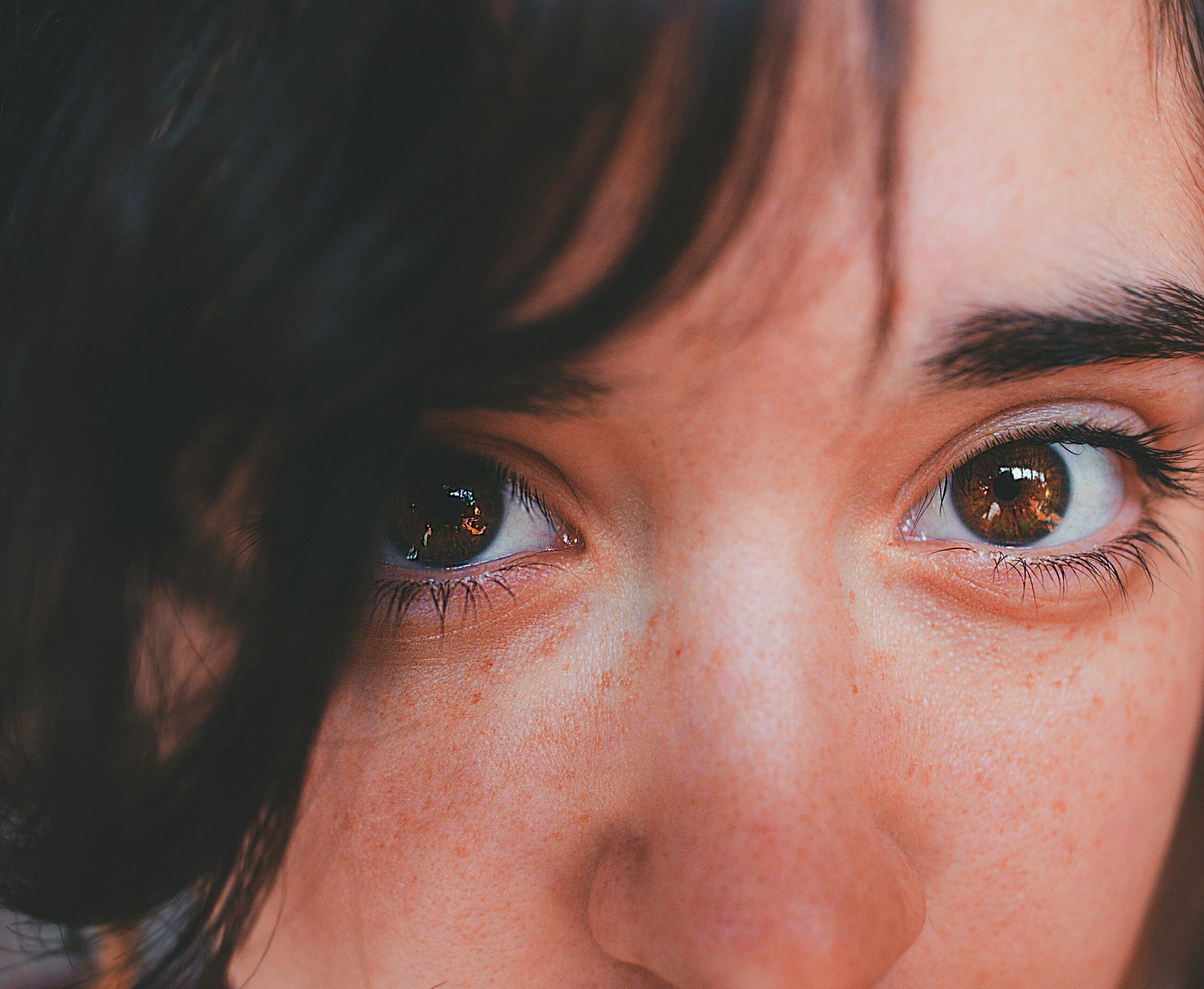 Close up of a young person who lives with chronic pain; eyes look both sad and hopeful.